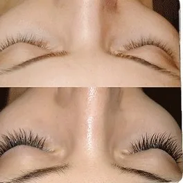 Lash Extensions Before and After