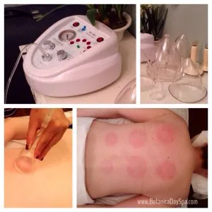 Cupping Massage